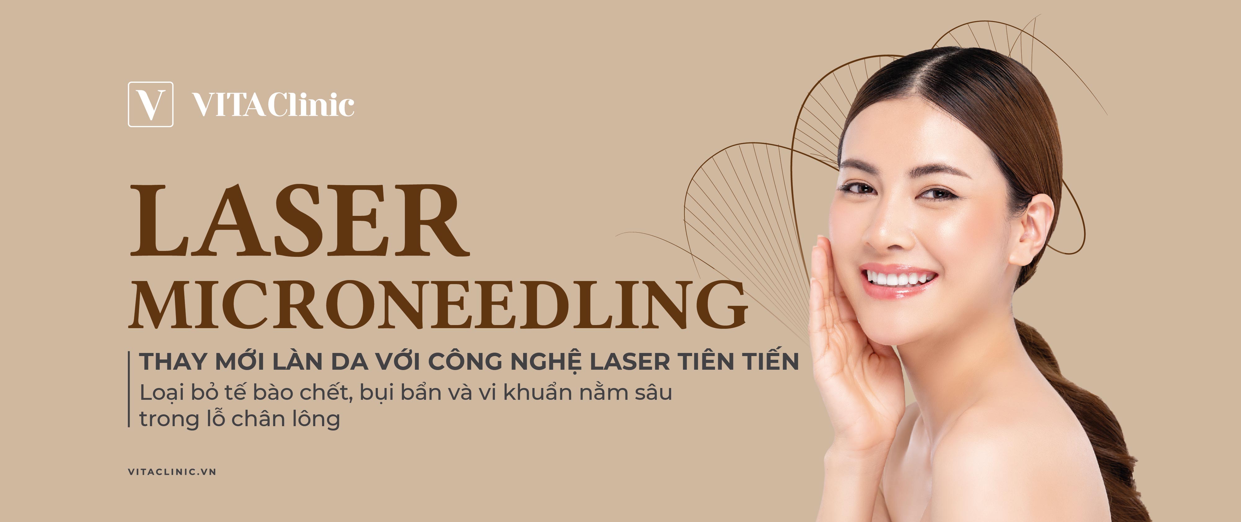 Laser Microneedling