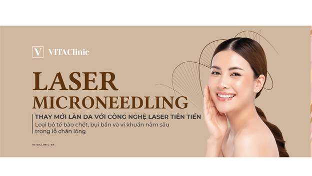 Loại bỏ mụn ẩn, trị sẹo tối ưu với Laser Microneedling