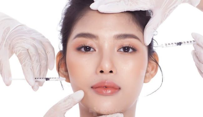 Tiêm filler là như thế nào?