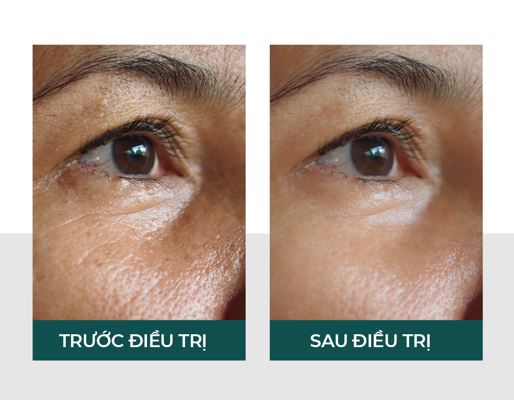 Hiệu quả của vitaclinic