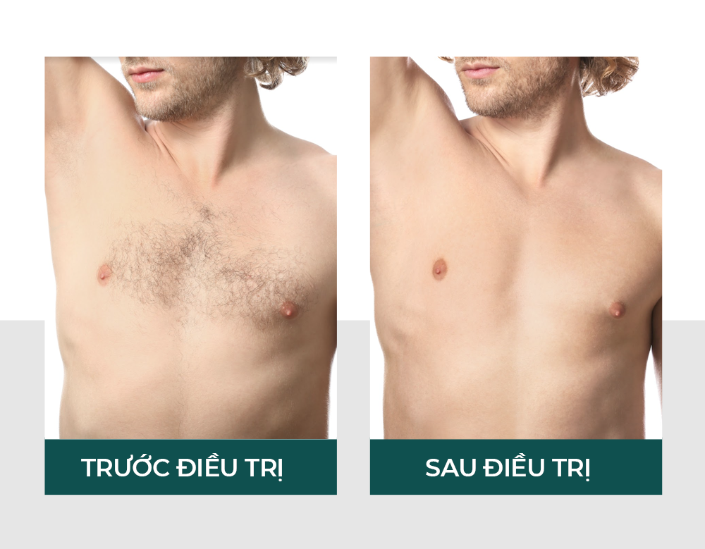 Hiệu quả của vitaclinic