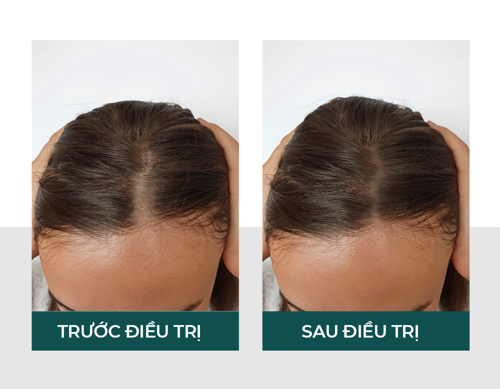 Hiệu quả của vitaclinic