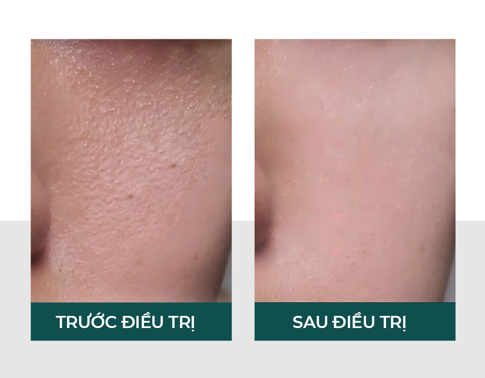 Hiệu quả của vitaclinic