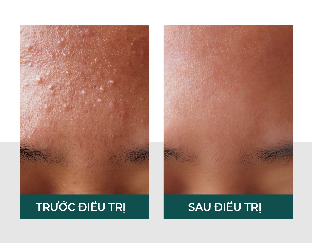 Hiệu quả của vitaclinic