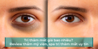 Trị thâm mắt giá bao nhiêu? Top 4 thẩm mỹ viện, spa trị thâm mắt uy tín