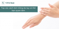 Top các cách làm trắng da tay có thể bạn quan tâm