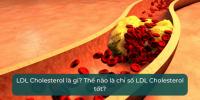 LDL Cholesterol là gì? Thế nào là chỉ số LDL Cholesterol tốt? | VITA Clinic