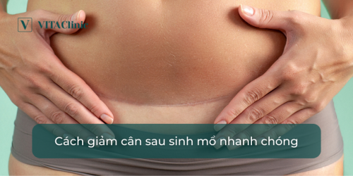 Top [11+] cách giảm cân sau sinh mổ nhanh chóng