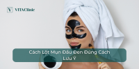 Cách Lột Mụn Đầu Đen Đúng Cách và Lưu Ý - VITA Clinic