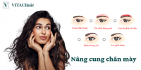Nâng Cung Chân Mày Có Đau Không? Được Bao Lâu? - VITA Clinic