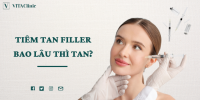 Tiêm tan Filler là gì?  Giải đáp liên quan đến tiêm tan filler - VITA Clinic