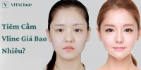 Tiêm cằm Vline có hại không? Những ai nên tiêm cằm? Giá bao nhiêu?