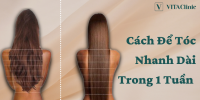 Cách Để Tóc Nhanh Dài Trong 1 Tuần - VITA Clinic