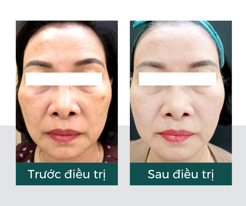 Hiệu quả của vitaclinic