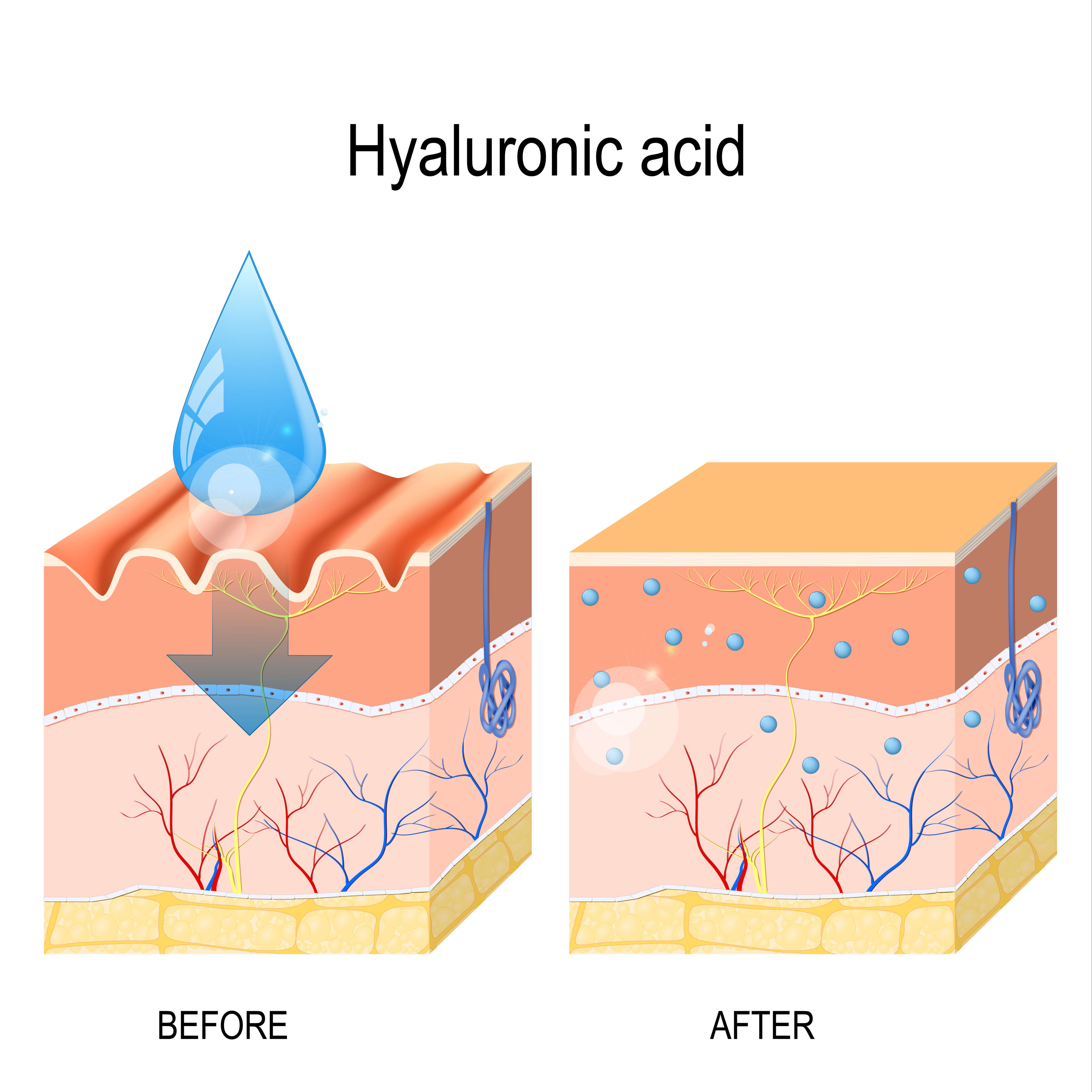 Derma Rejuvenation XFC+