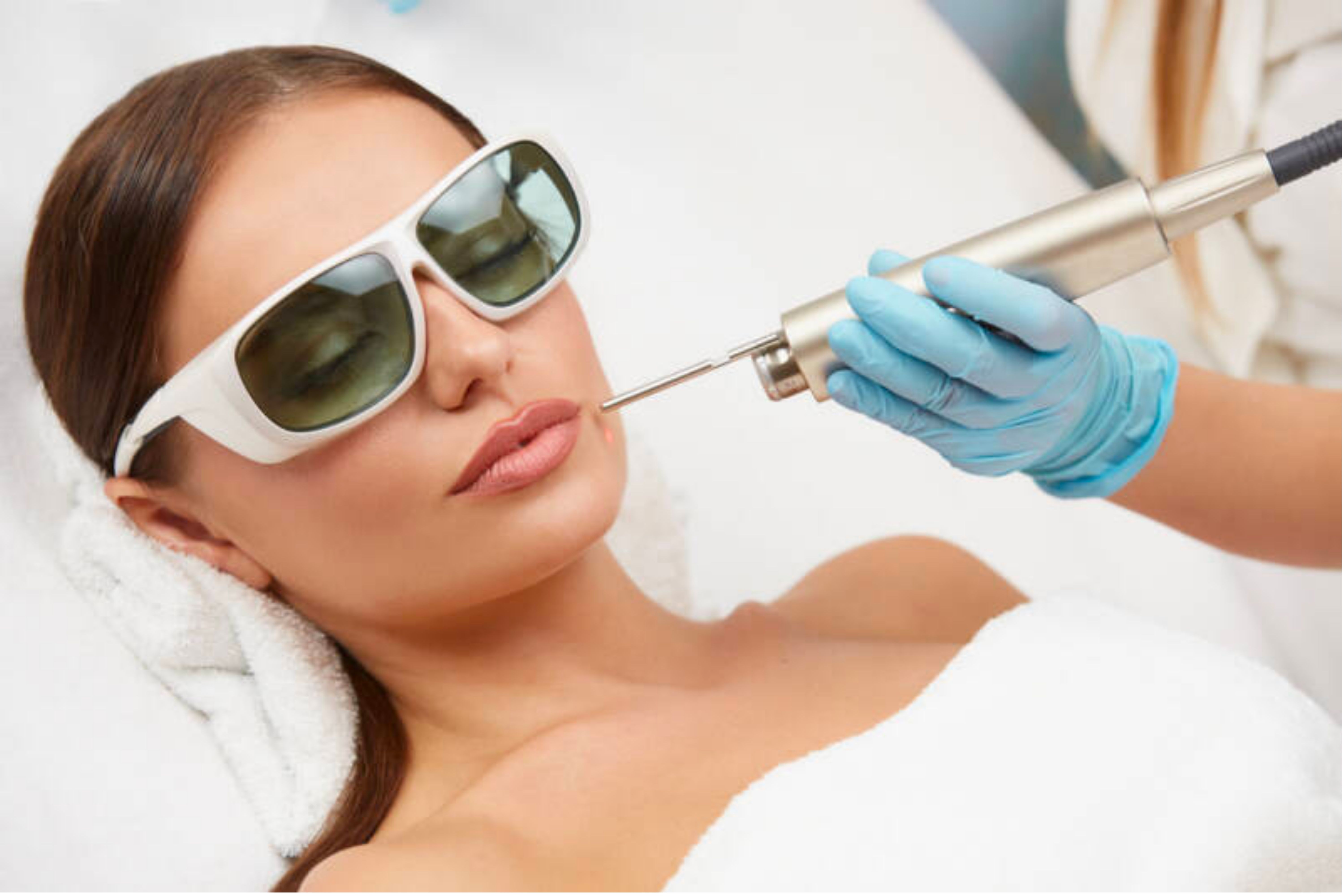 Laser Microneedling