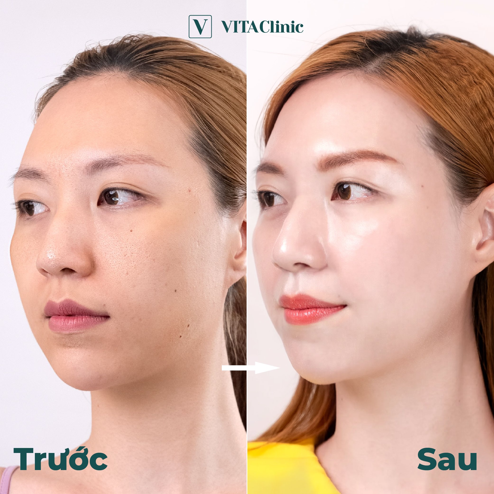 Hiệu quả của vitaclinic