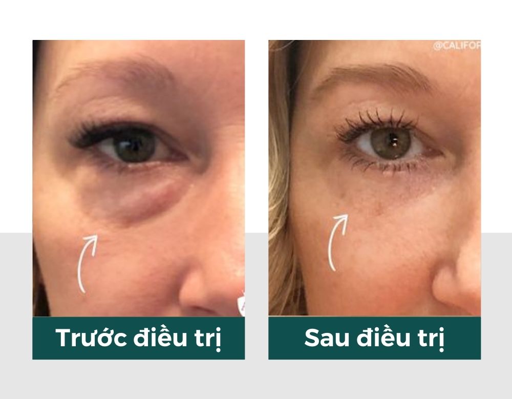 Hiệu quả của vitaclinic