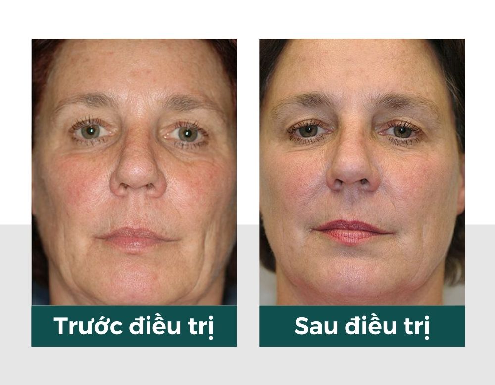 Hiệu quả của vitaclinic