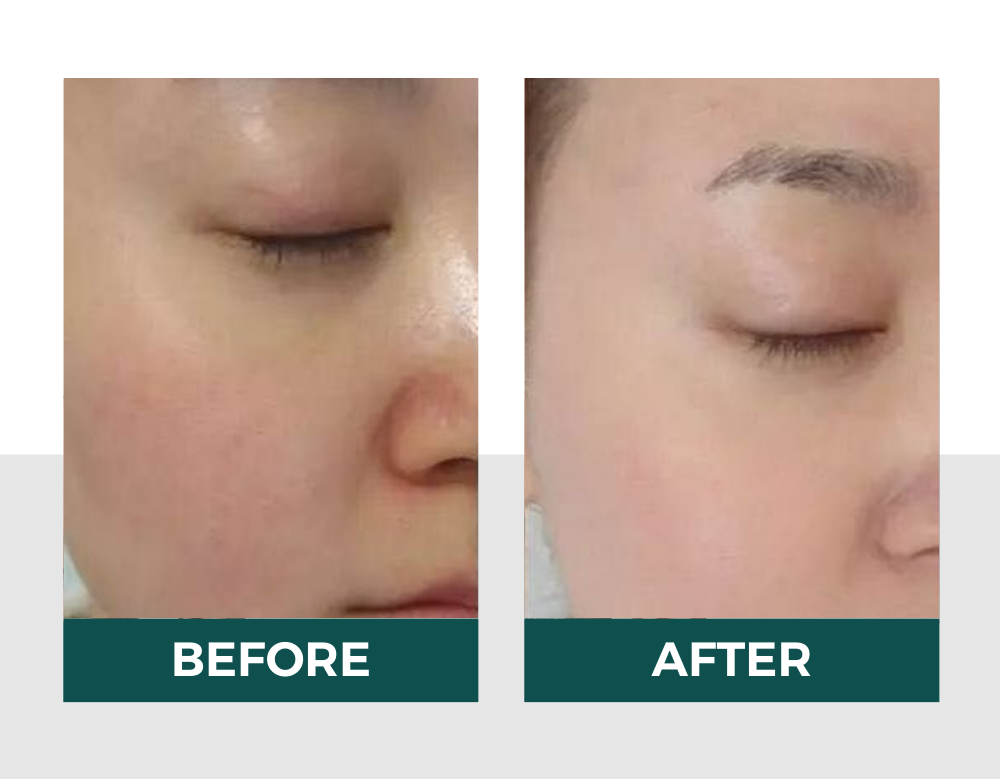 Hiệu quả của vitaclinic