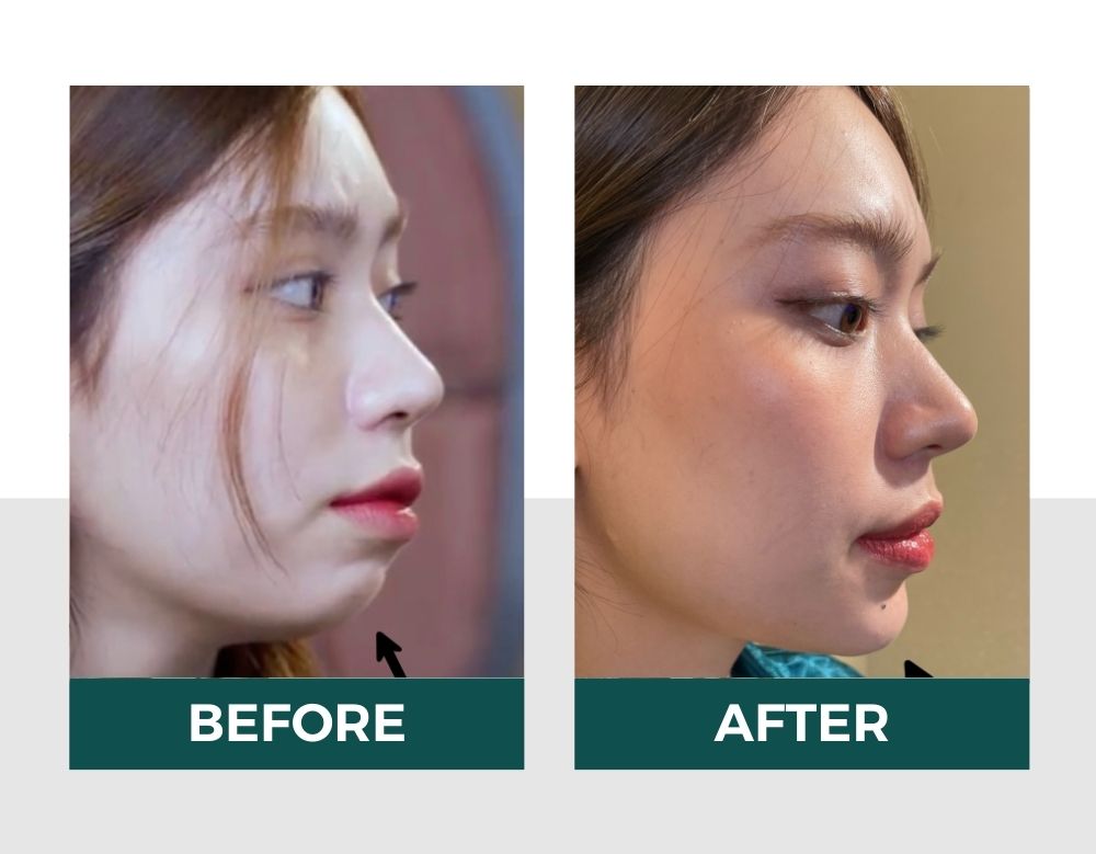 Hiệu quả của vitaclinic