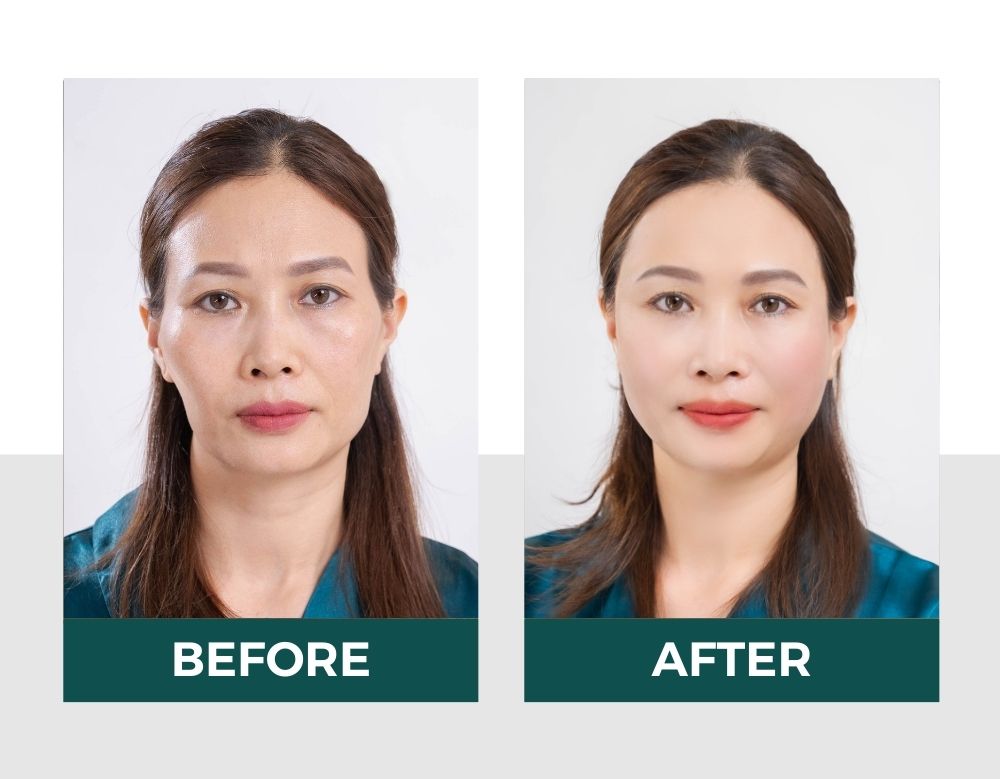 Hiệu quả của vitaclinic