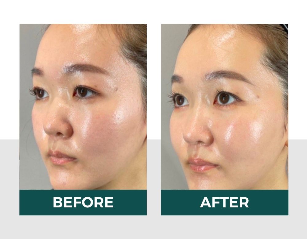 Hiệu quả của vitaclinic