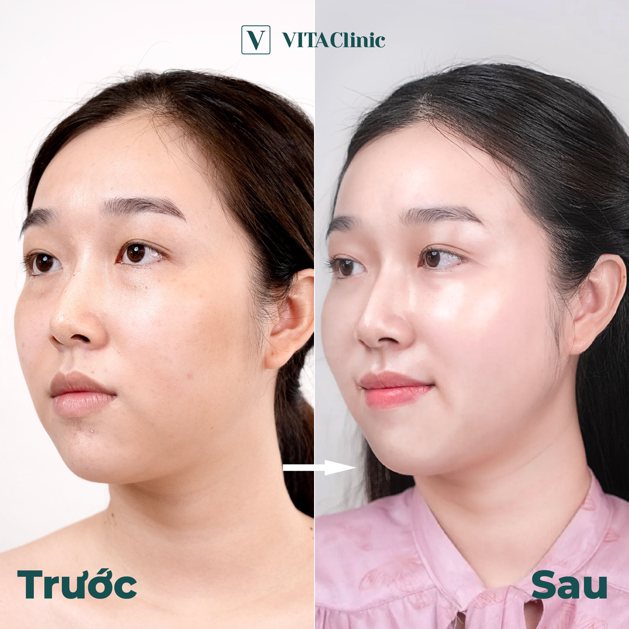 Hiệu quả của vitaclinic