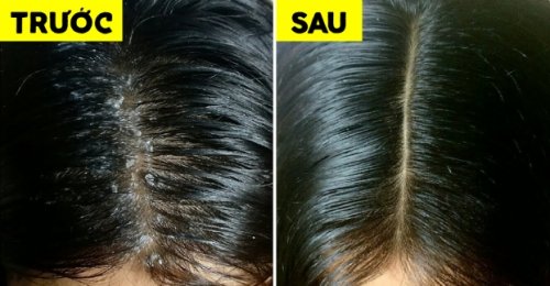 Hiệu quả của vitaclinic