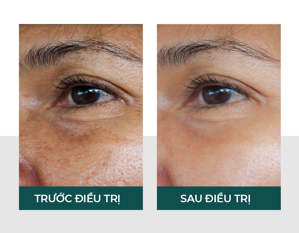 Hiệu quả của vitaclinic