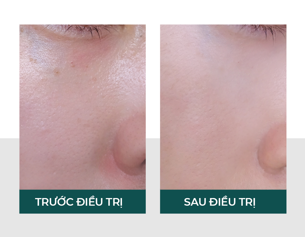 Hiệu quả của vitaclinic