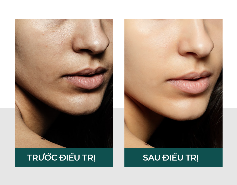 Hiệu quả của vitaclinic